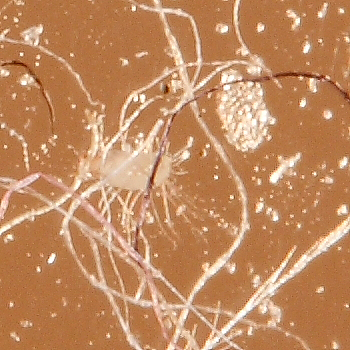 ID microacari
